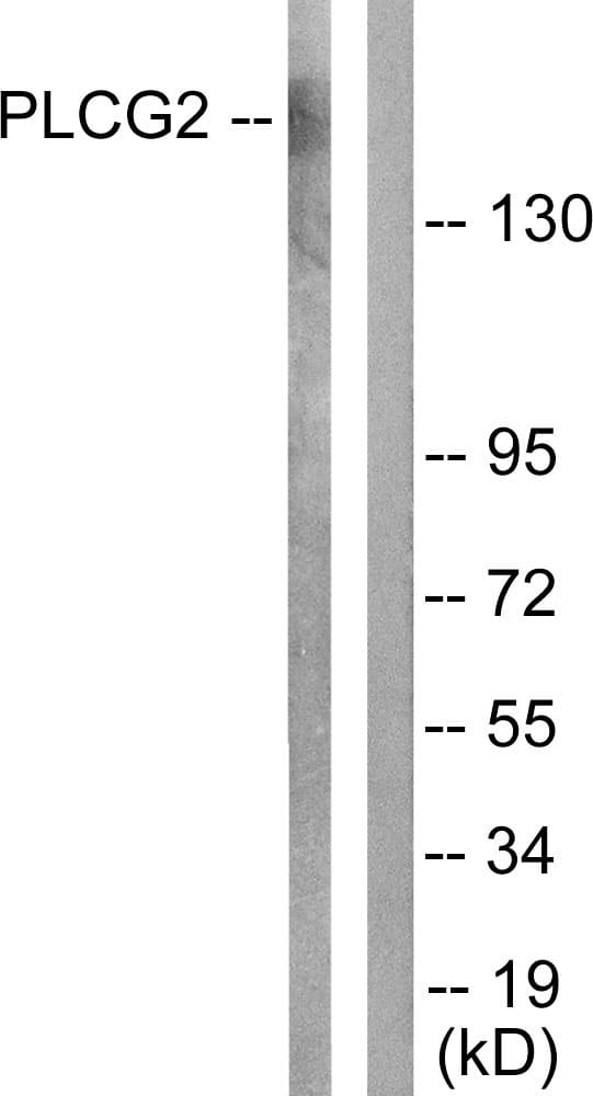 PLCG2 / PLC Gamma 2 Antibody (aa1186-1235)