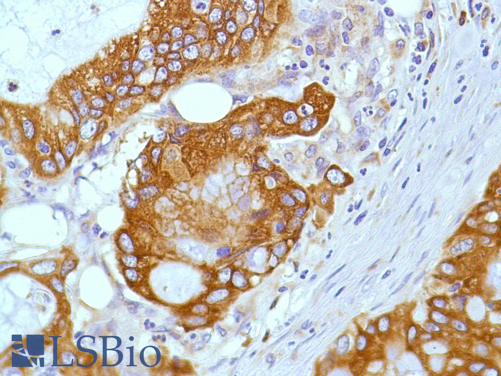 PTGS2 / COX2 / COX-2 Antibody (C-Terminus, clone SP21)