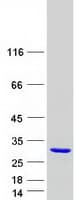 Human DPCD Protein (Recombinant Myc-DDK (Flag))