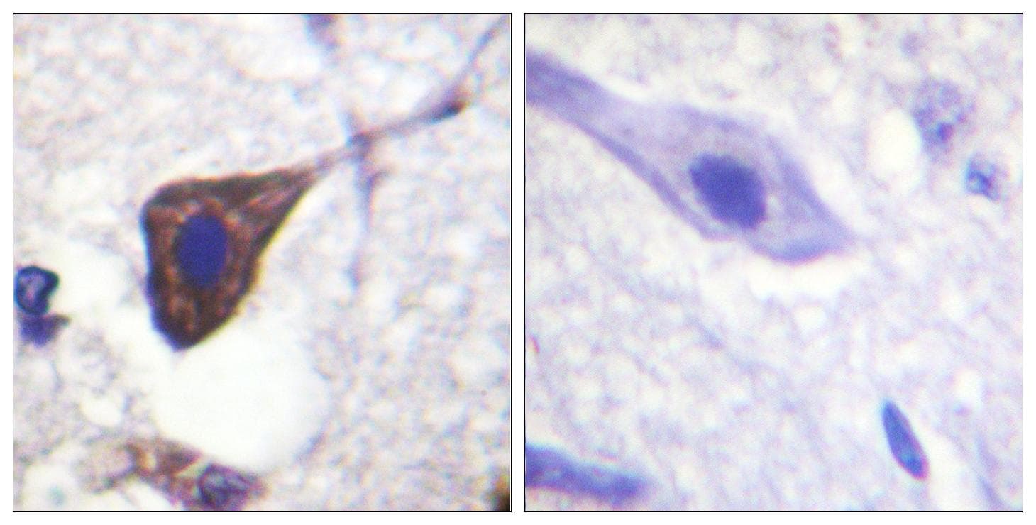 Polyclonal Rabbit anti-Human ADRB2 Antibody (phospho-Ser346, IHC, IF, WB)