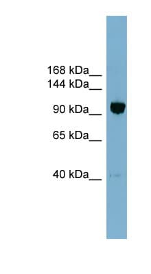 Polyclonal Rabbit anti-Human OSBPL8 Antibody (aa755-804, WB)