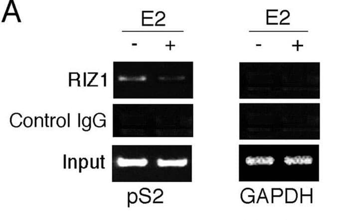 PRDM2 / RIZ1 Antibody (clone 33AT1045)