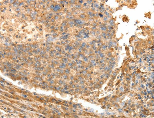 PSMD9 / 26S Proteasome Antibody