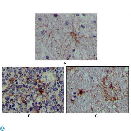 S100B / S100 Beta Antibody