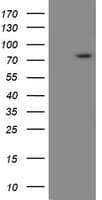 Monoclonal Mouse anti-Human SKIL / SNO / SnoN Antibody (clone OTI1H2, WB)