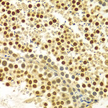 MYSM1 Antibody