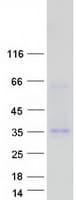 Human DYNAP Protein (Recombinant Myc-DDK (Flag))