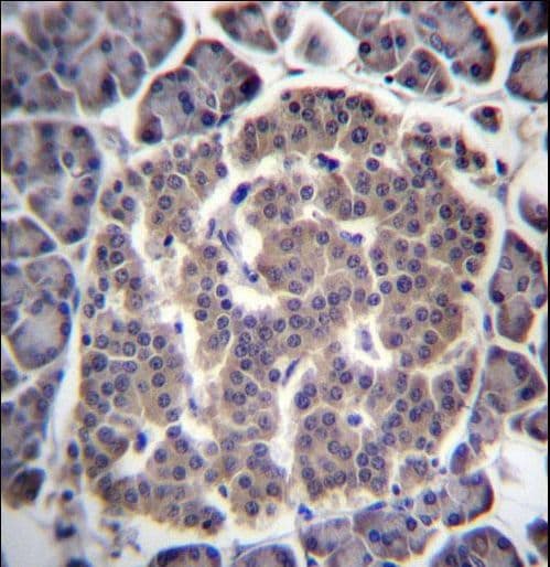 UGGT1 / UGGT Antibody (aa1226-1254)