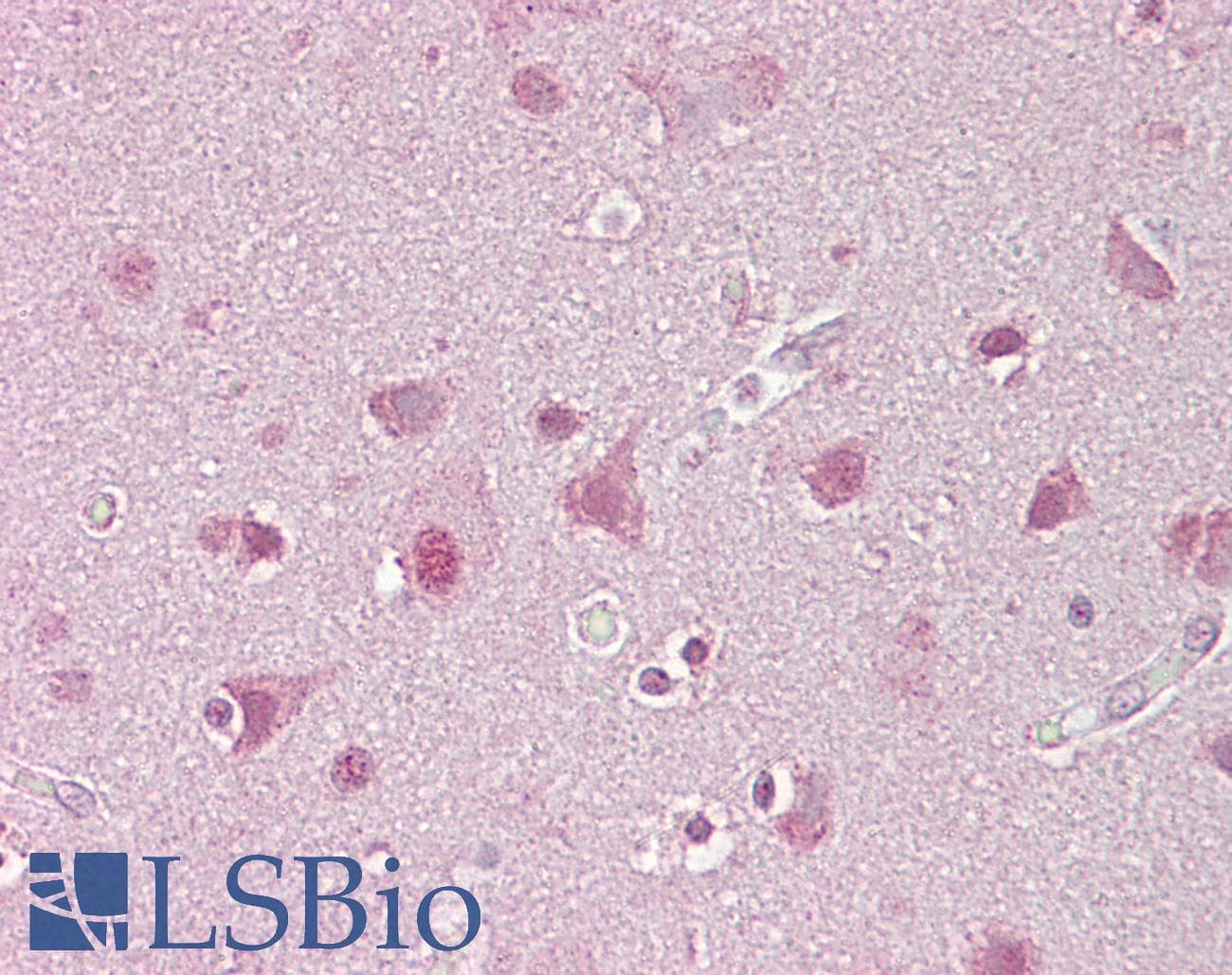 SREBF1 / SREBP-1 Antibody (aa461-510)