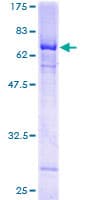 Human ALX / HSH2D Protein (Recombinant GST)