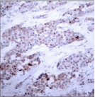 Polyclonal Rabbit anti-Human ATF4 Antibody (IHC, WB)