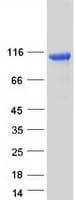 Human MTSS1L Protein (Recombinant Myc-DDK (Flag))