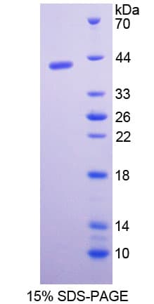 Rat PGC / Pepsin C Protein (Recombinant His)