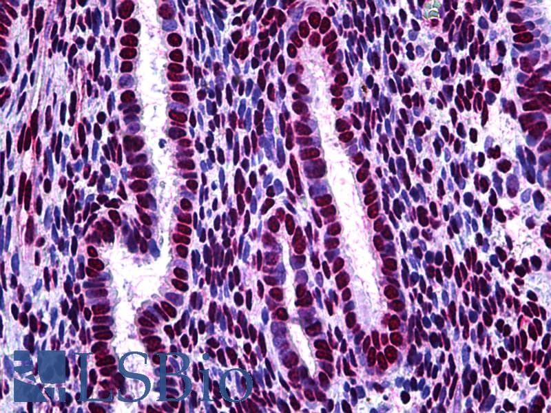 IHC-plus™ Polyclonal Rabbit anti-Human STAT1 Antibody (phospho-Ser727, IHC, WB)