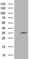 DNTTIP1 / TDIF1 Antibody (clone OTI4D1)