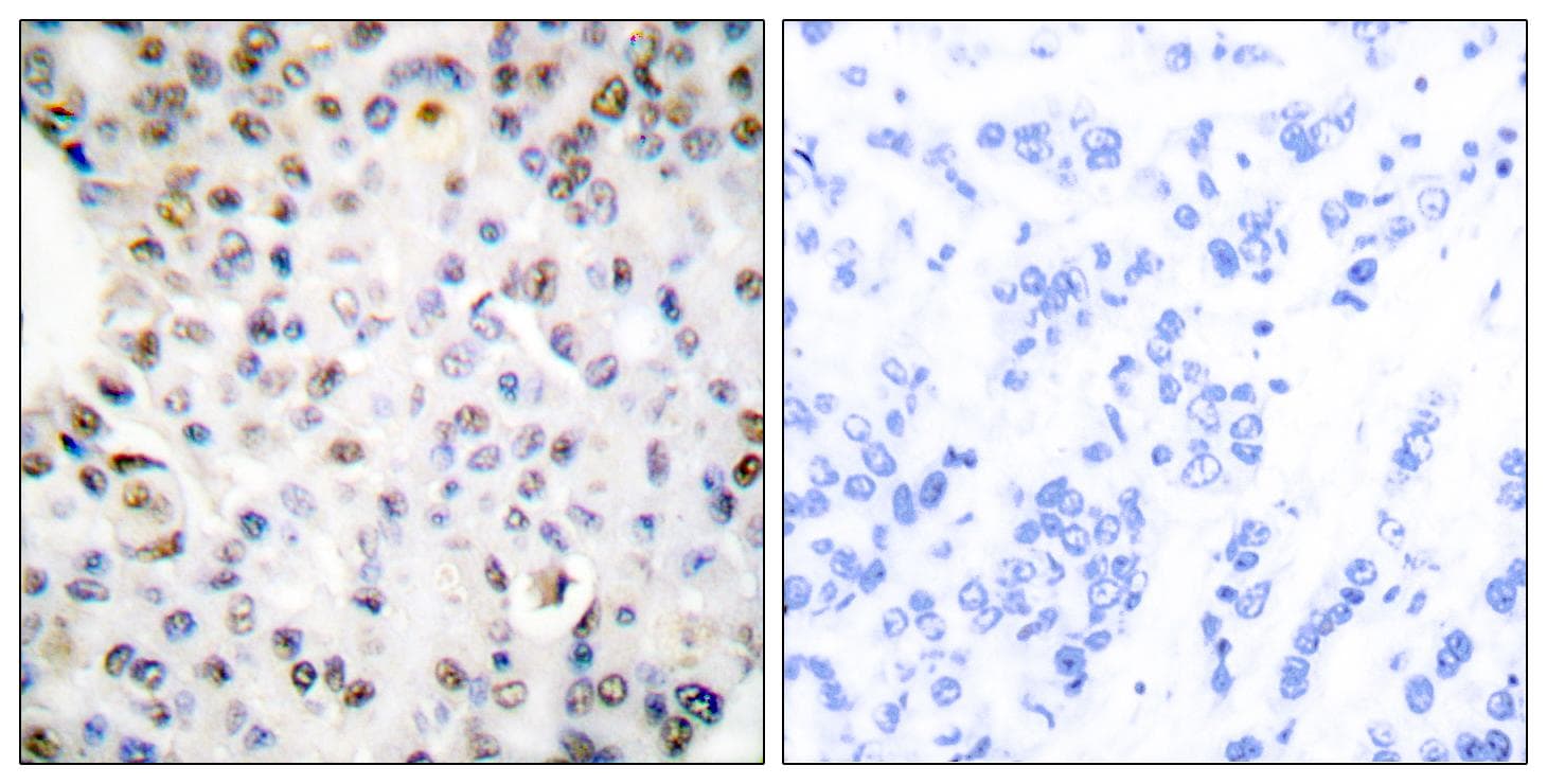 Polyclonal Rabbit anti-Human RXRG Antibody (IHC, IF, WB)