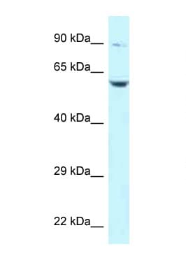 Polyclonal Rabbit anti-Human SNK / PLK2 Antibody (aa261-310, WB)