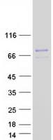 Human MID1 Protein (Recombinant Myc-DDK (Flag))