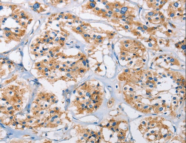 Polyclonal Rabbit anti-Human CTSL / Cathepsin L Antibody (IHC, WB)