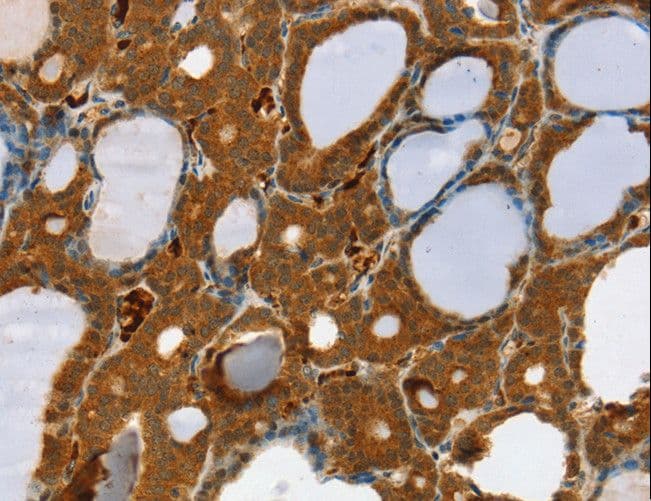 RAB27A / RAB27 Antibody