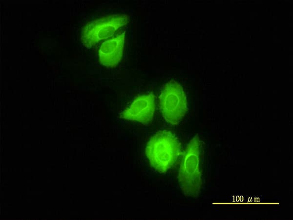 DNAJC3 / p58IPK Antibody (clone 4D3-F2)