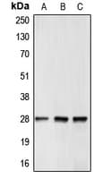 Polyclonal Rabbit anti-Human BCL2 / Bcl-2 Antibody (Internal, IHC, WB)