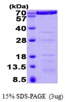 Human ANXA6/Annexin A6/Annexin VI Protein (Recombinant His)