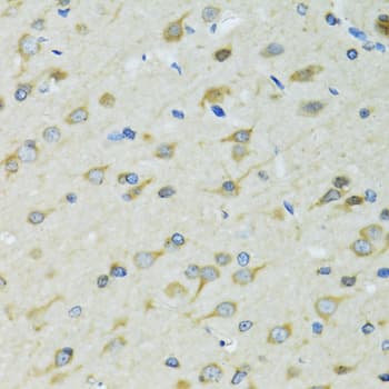 Polyclonal Rabbit anti-Human Dynactin 2 / Dynamitin Antibody (IHC, IF, WB)