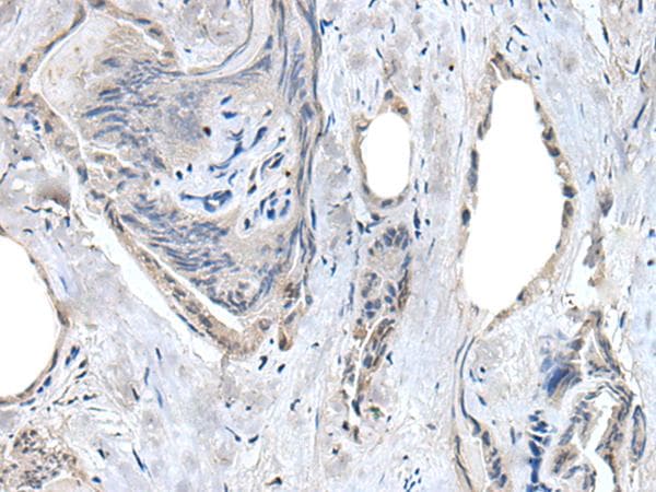 Polyclonal Rabbit anti-Human RASSF8 Antibody (IHC)