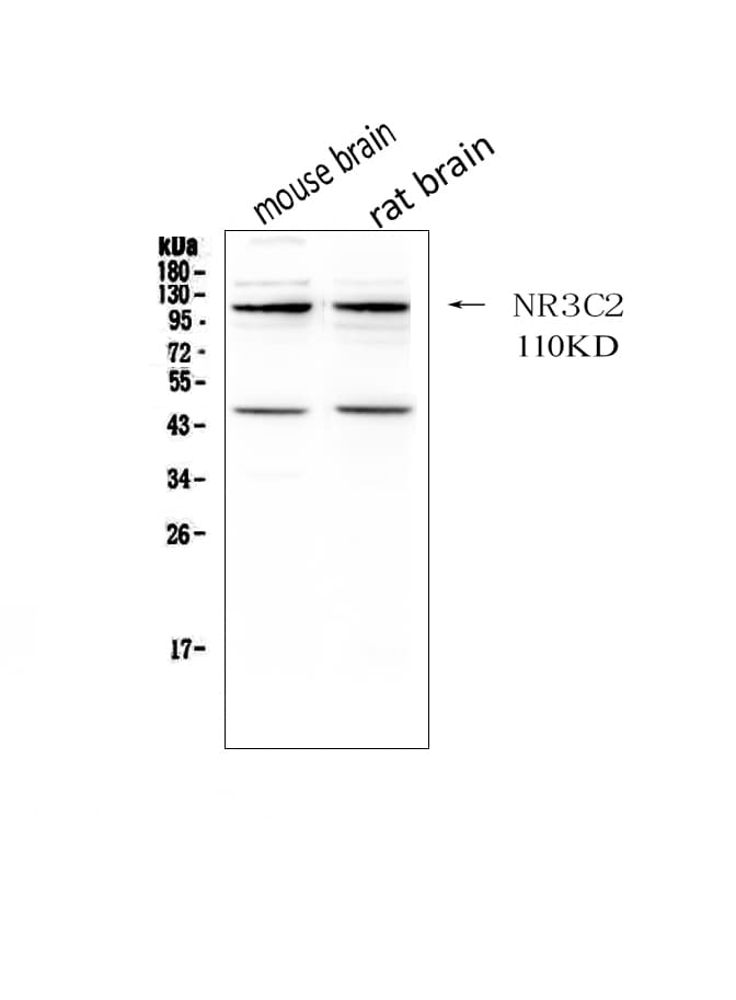 Mineralocorticoid Receptor Antibody (aa950-984)