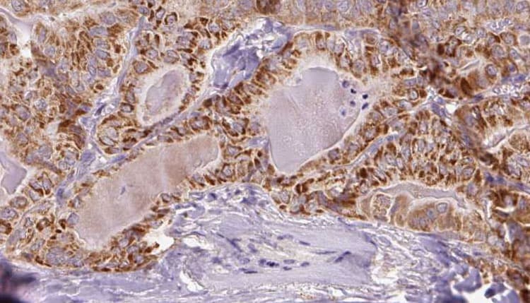 SLC7A11 / XCT Antibody