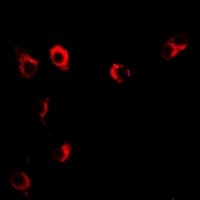 VILIP / VSNL1 Antibody