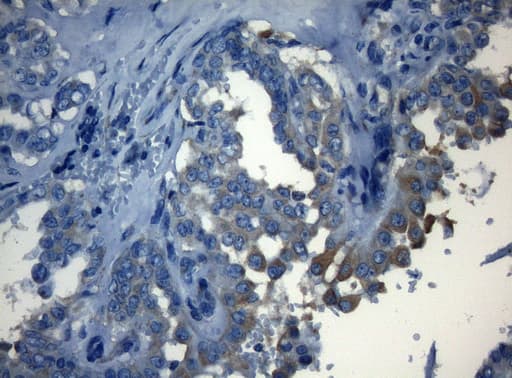 Monoclonal Mouse anti-Human HOXC10 Antibody (clone OTI1A9, aa1-262, IHC, WB)