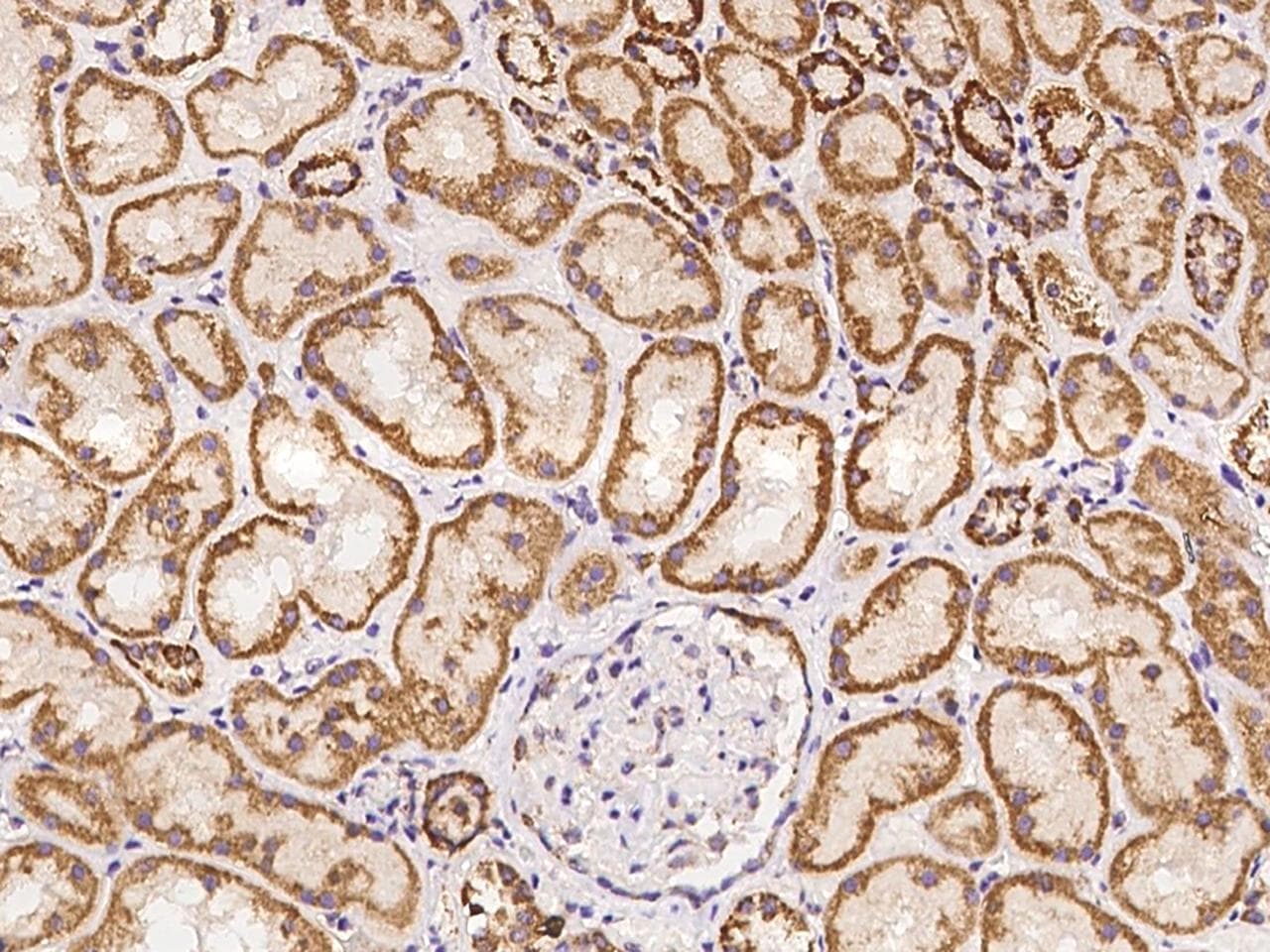 MRPL52 Antibody