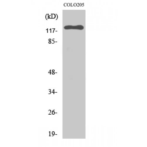 EPHB6 / EPH Receptor B6 Antibody (830-910 aa, C-terminal)