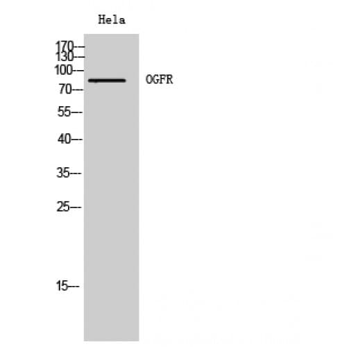 Polyclonal Rabbit anti-Human OGFR Antibody (110-190 aa, Internal, WB)