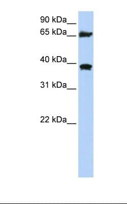 HSPA9 / Mortalin / GRP75 Antibody (C-Terminus, Biotin)