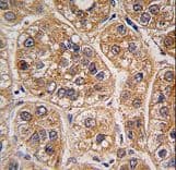AKR1A1 Antibody (aa293-325)