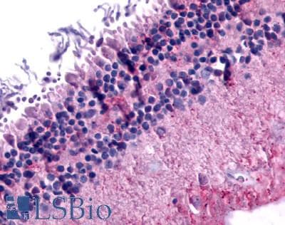 PathPlus™ GRM6 / MGLUR6 Antibody (N-Terminus)