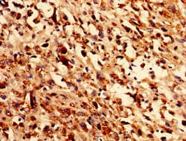 GLE1 Antibody
