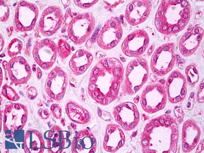 IHC-plus™ Monoclonal Rabbit anti-Human SNX1 Antibody (clone EPR7178, Internal, IHC, WB)
