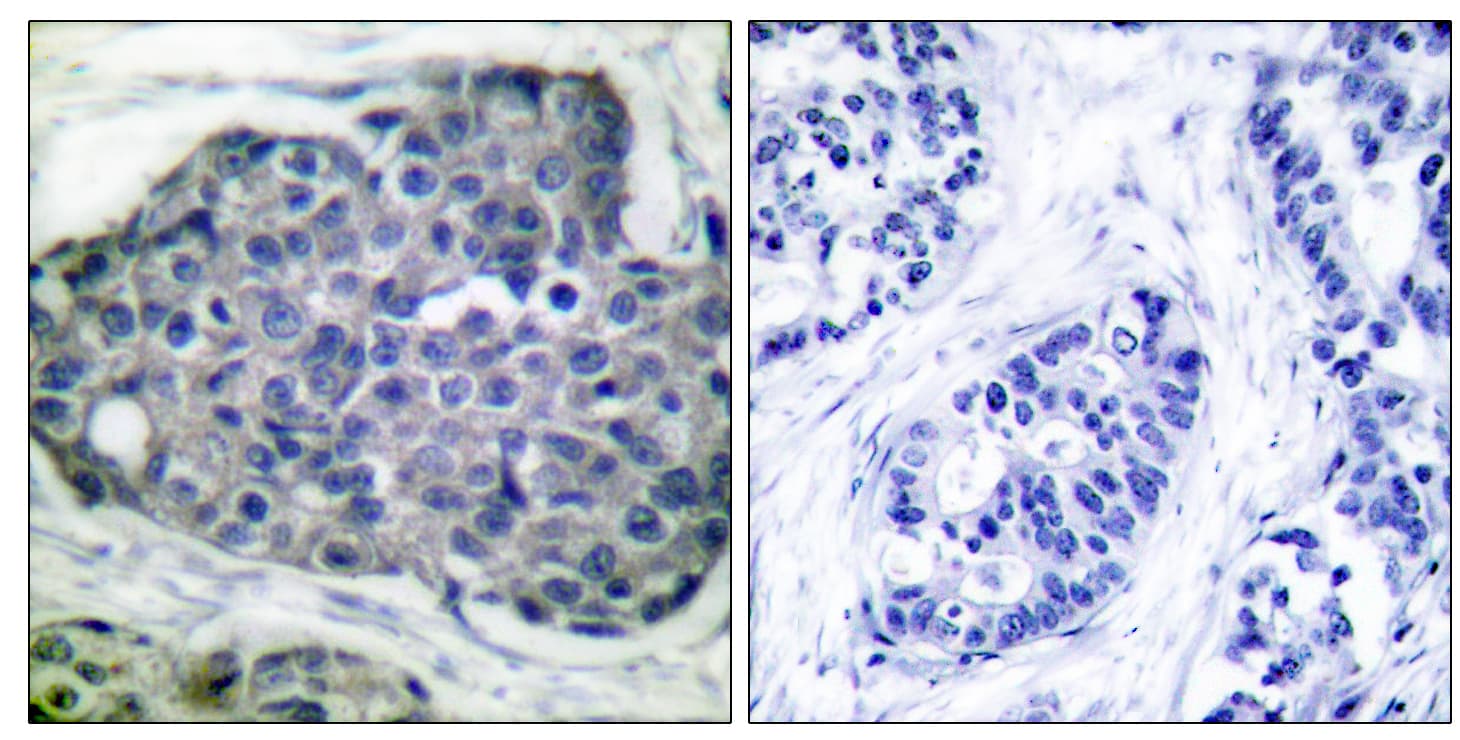Acetyl-CoA Carboxylase / ACC Antibody (phospho-Ser80)