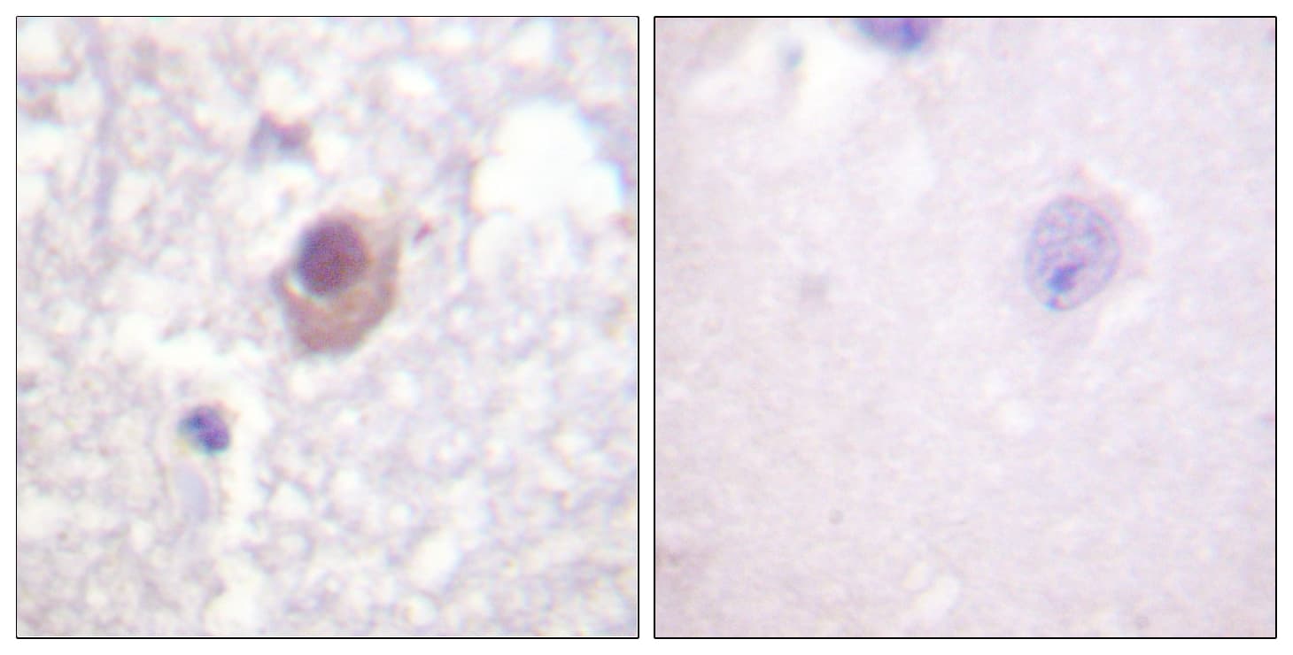 SGK1 / SGK Antibody (aa41-90)