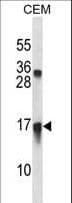 Polyclonal Rabbit anti-Human CXCL11 Antibody (aa64-93, WB)