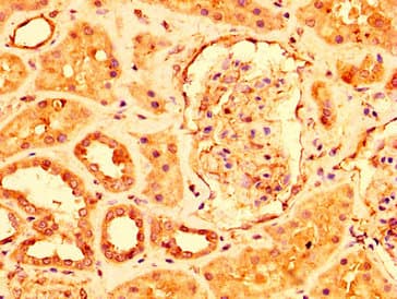 Polyclonal Rabbit anti-Human USP4 Antibody (IHC, IF, WB)