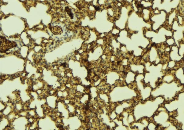 SSBP2 Antibody