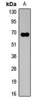 BIRC3 / cIAP2 Antibody