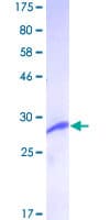 Human HMT / HNMT Protein (Recombinant GST)