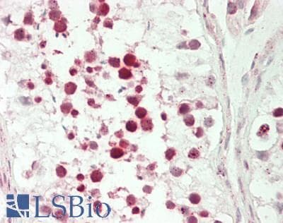 IHC-plus™ Polyclonal Rabbit anti-Human YAF2 Antibody (aa50-100, IHC, WB)