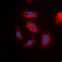 IRS1 Antibody (Internal)